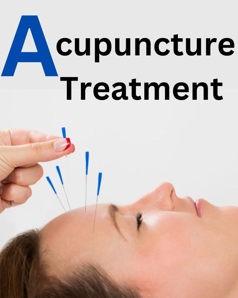 Acupuncture Treatment