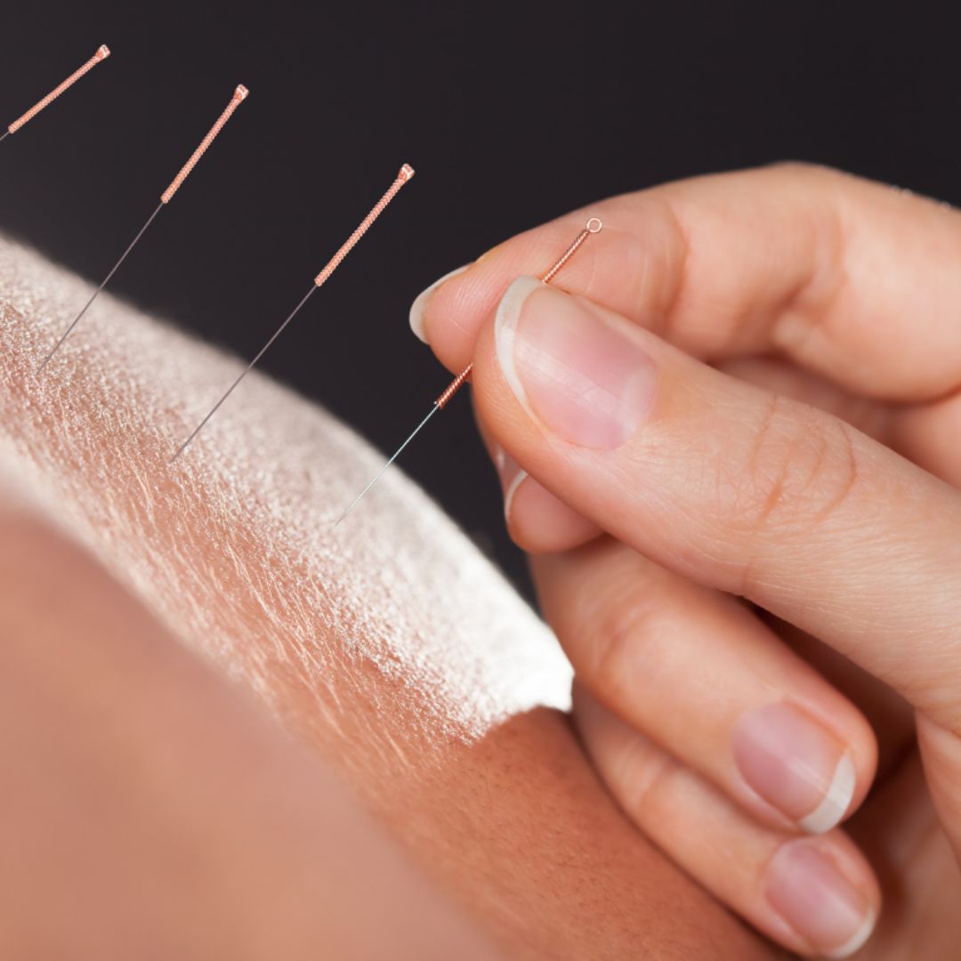 acupuncture treatment murfreesboro