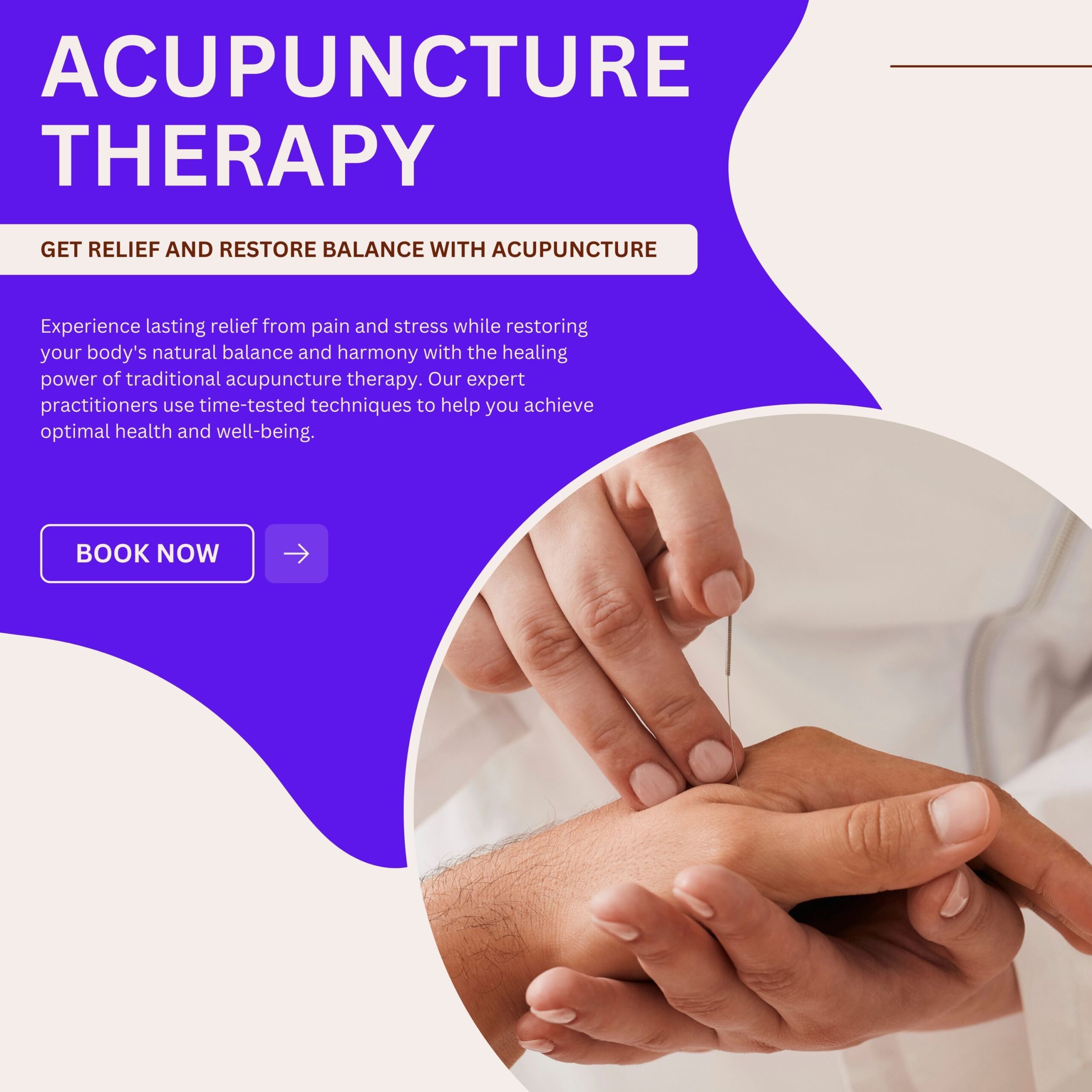 Acupuncture treatment Murfreesboro