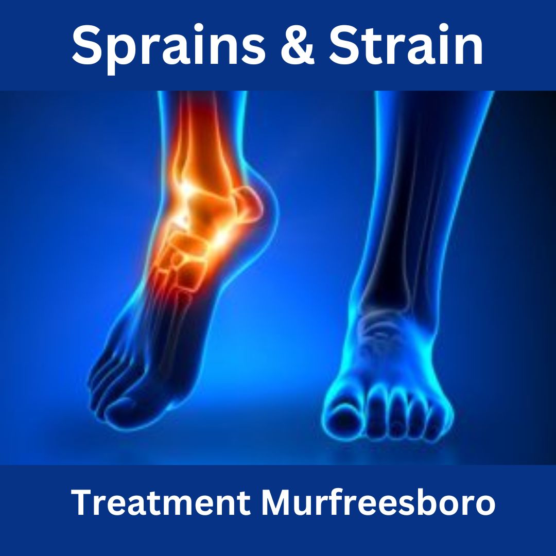 Sprains and Strains Treatment