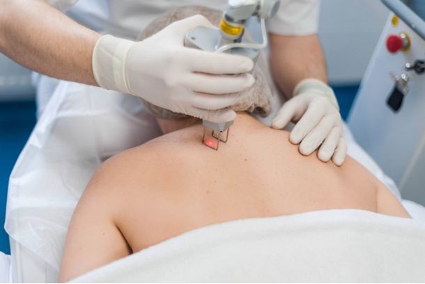 cold laser treatment