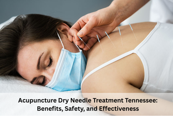 Acupuncture Dry Needle Treatment