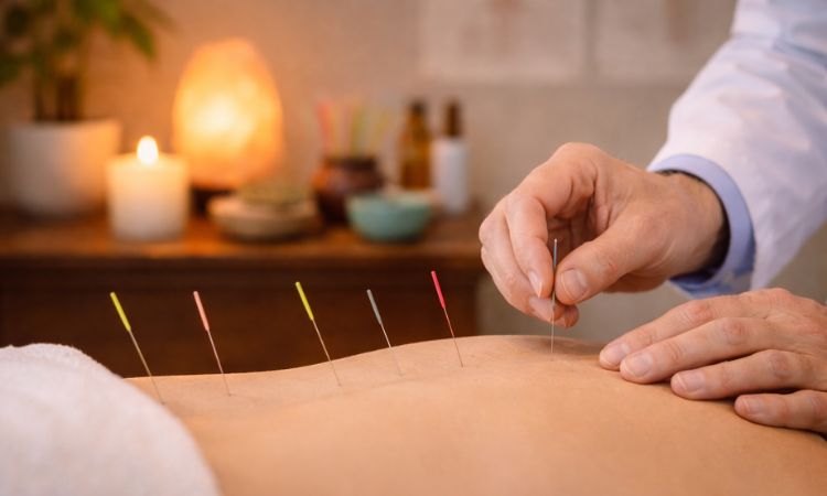 Headaches Acupuncture in Middle Tennessee Headaches Acupuncture in Middle Tennessee