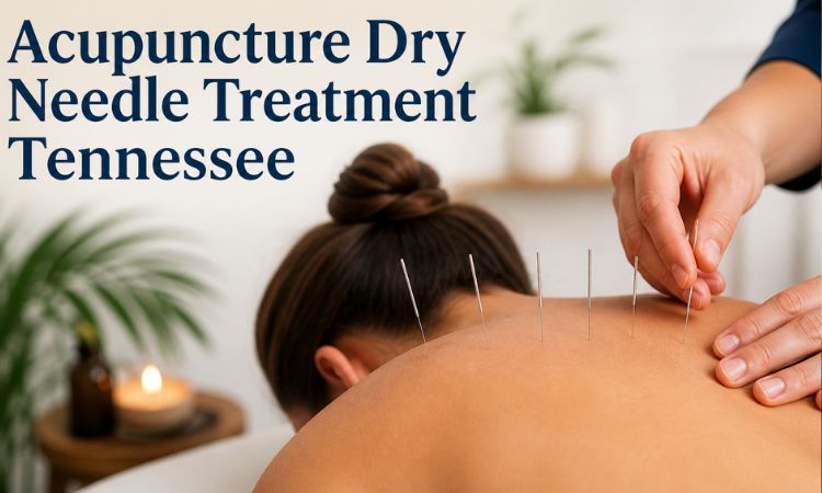 A therapist performing acupuncture dry needling on a woman’s upper back during a relaxing treatment session in Tennessee.