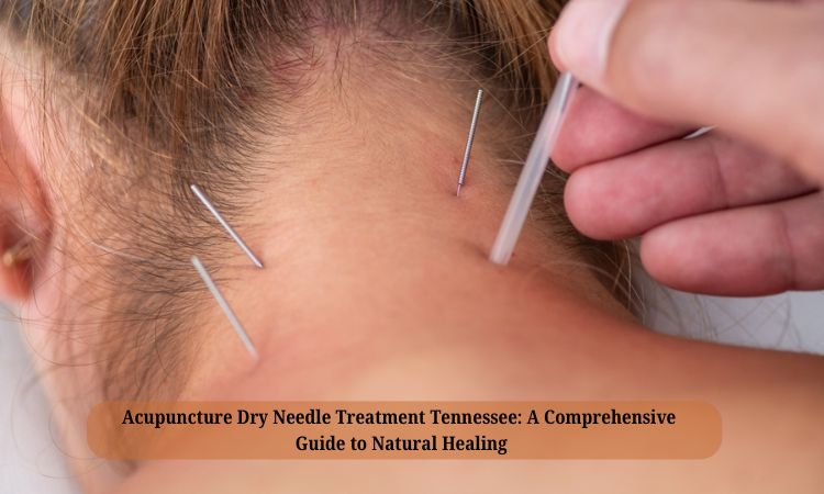 Acupuncture Dry Needle Treatment Tennessee