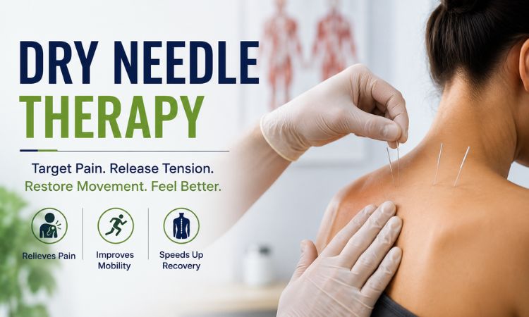 Dry Needle Treatment Tennessee