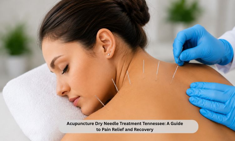acupuncture and dry needling in Tennessee